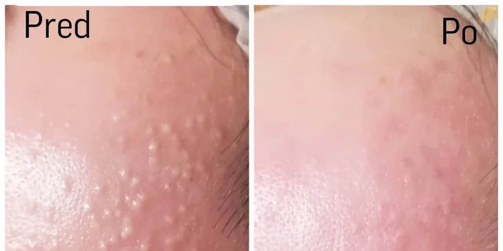 Šetrné či hloubkové manuální čištění pleti s masáží a maskou i 15% sleva na produkty