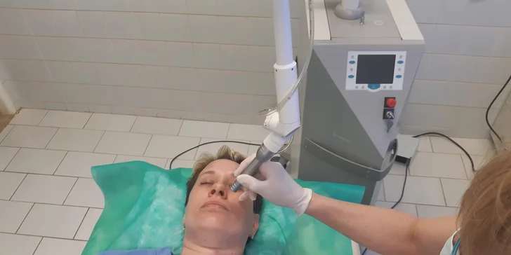 Zbavte se nežádoucích chloupků: trvalá epilace horního rtu pomocí laseru