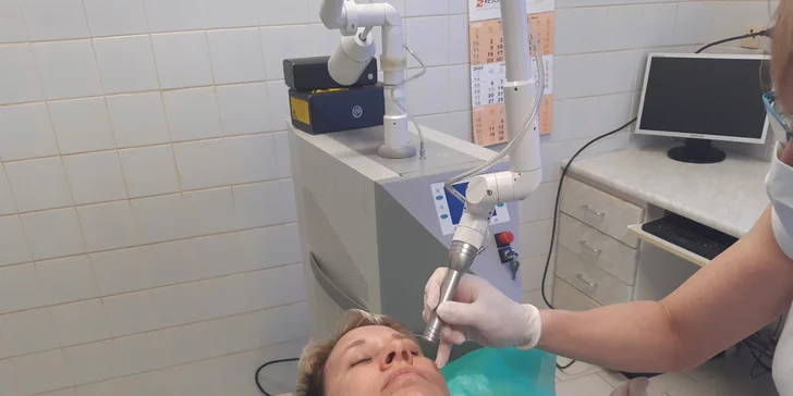 Zbavte se nežádoucích chloupků: trvalá epilace horního rtu pomocí laseru
