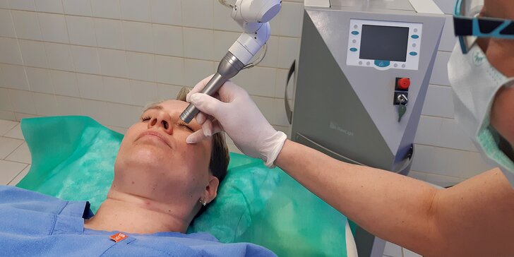 Zbavte se nežádoucích chloupků: trvalá epilace horního rtu pomocí laseru