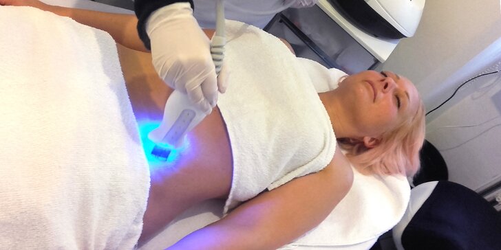 Neinvazivní liposukce modrým laserem: 1 nebo 4 ošetření partie dle výběru