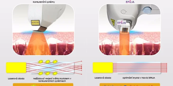 Pánská trvalá lékařská laserová epilace oblasti dle výběru