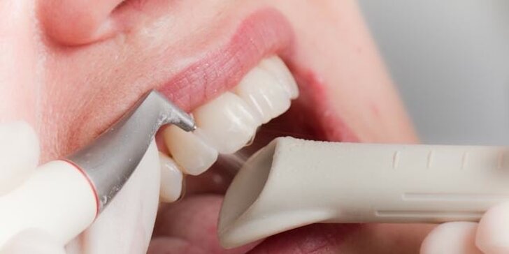 Precizní dentální hygiena s air flow na klinice ArtStom