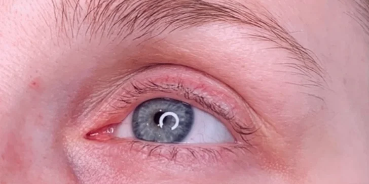 Neodolatelný pohled: Lash lifting a péče o řasy