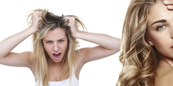 249 Kč za odborné vyšetření při problémech s padáním, třepením a maštěním vlasů i s lupy. Profesionální péče centra Clinical Hair & Skin.