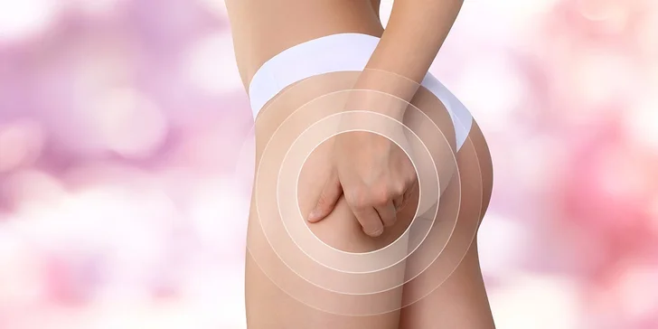 Přístrojová podtlaková masáž - účinná léčba celulitidy
