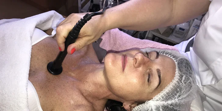 Omlazení a vypnutí pleti obličeje, dekoltu, krku i podbradku pomocí radiofrekvence