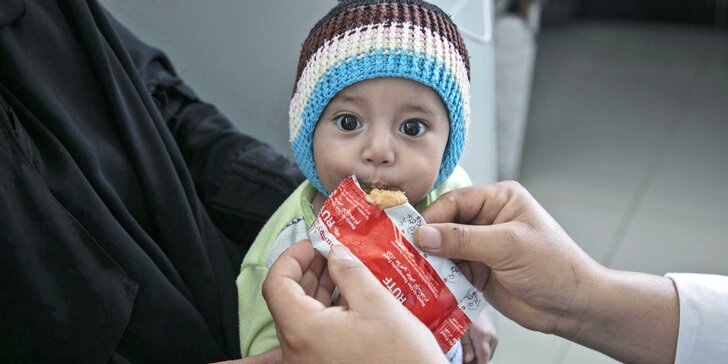 Pomozte s UNICEF zachránit děti v Jemenu: příspěvek na výživu, pitnou vodu i zdravotní péči
