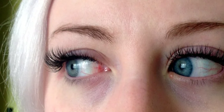 Prodlužování řas metodou řasa na řasu nebo volume lashes 2D až 5D