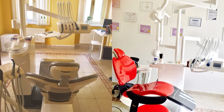Dejte si spravit zub fotokompozitní plombou z nejkvalitnějšího materiálu