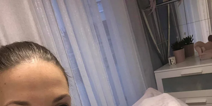 Pro zdravou a krásnou pleť: ošetření mikrojehličkovou mezoterapií