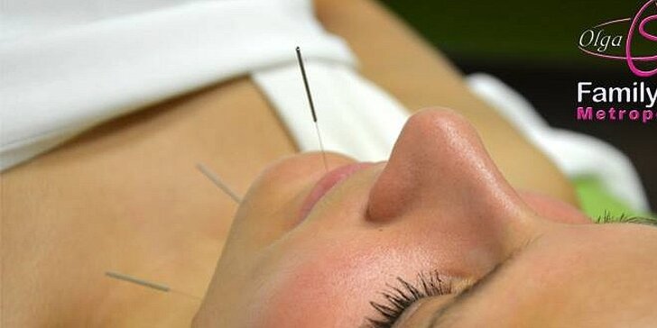 Kosmetická akupunktura ve Fitness Olgy Šípkové - omlazení a odstranění vrásek přírodní cestou spojené s relaxací a odpočinkem