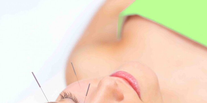 Kosmetická akupunktura pro boj proti vráskám
