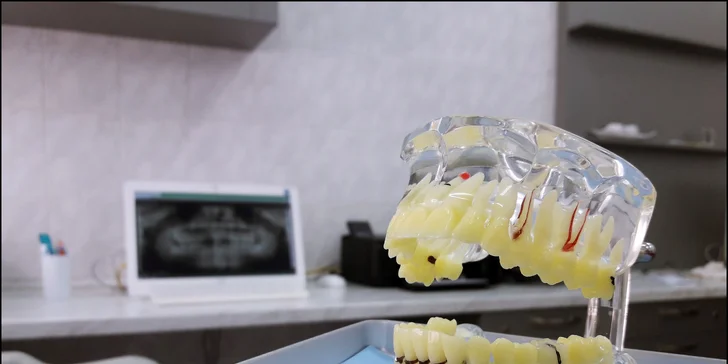 Kompletní dentální hygiena: odstranění zubního kamene, air flow, fluoridace a instruktáž