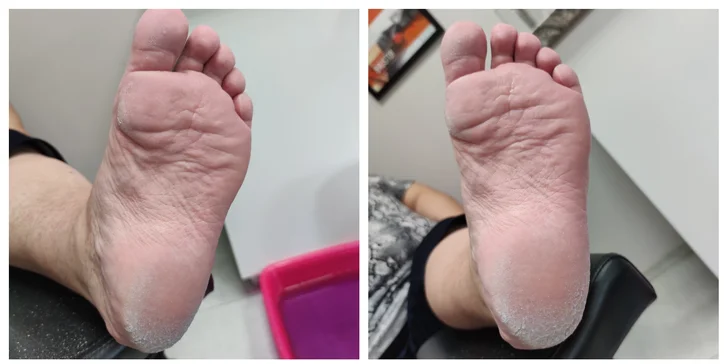 Pedikúra: kombinovaná i wellness péče o nohy