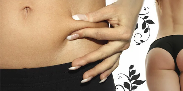 599 Kč za neinvazivní liposukci břicha, boků,  zadečku nebo stehen. Zeštíhlete s Accent RF - rychle, efektivně, bezbolestně a se slevou 73 %.