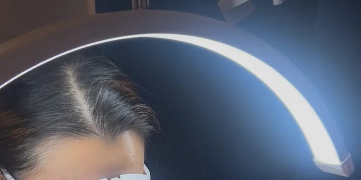 V úvodu procedury kosmetička nejdříve vaši pleť důkladně očistí od make-upu, nečistot a přebytečného mazu.