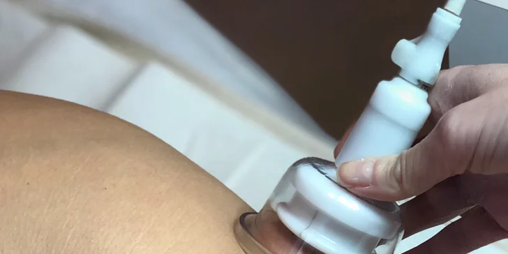 Hubnutí pomocí neinvazivní ultrazvukové liposukce i možnost lymfodrenáže a LPG