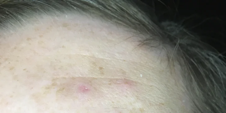 Oslnivý pohled díky lash liftingu vč. výživného séra