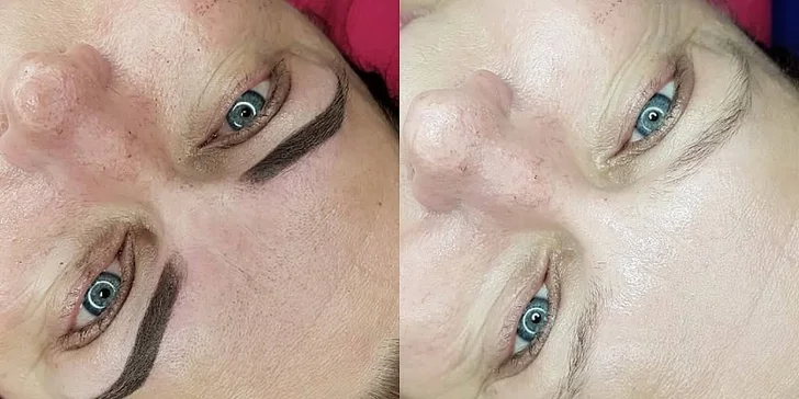 Krásné obočí až na dva roky: permanentní make-up