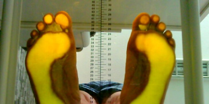 Komplexní podologické vyšetření: nožní klenby, chůze, stoj a držení těla