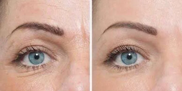 Hydrodermabraze: čištění, peeling a hydratace pleti v jednom