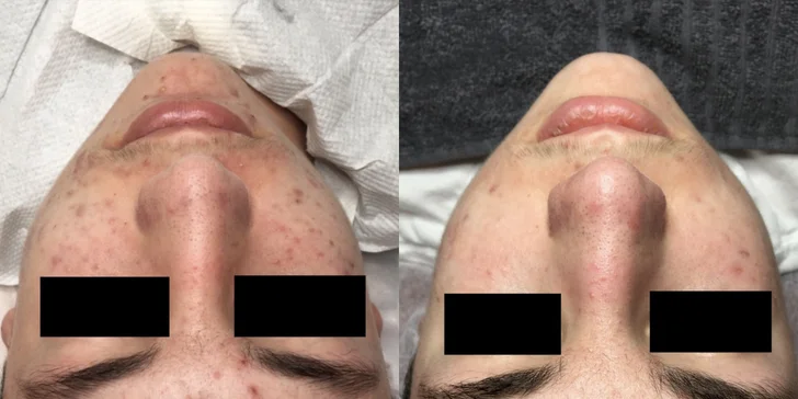 Kosmetické ošetření pleti s možností manikúry či lash liftingu