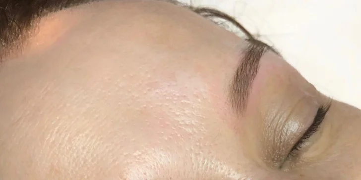 Udělejte něco jen pro sebe: permanentní make-up obočí a rtů