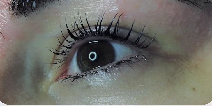 Kosmetické ošetření mastné a problematické pleti či lash lifting řas