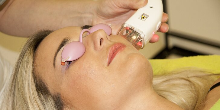 Laserové ošetření očního okolí, obličeje, krku a dekoltu vč. arganového oleje a kolagenu