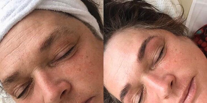 Podzimní kosmetické ošetření: kompletní péče o vaši pokožku vč. masáže obličeje
