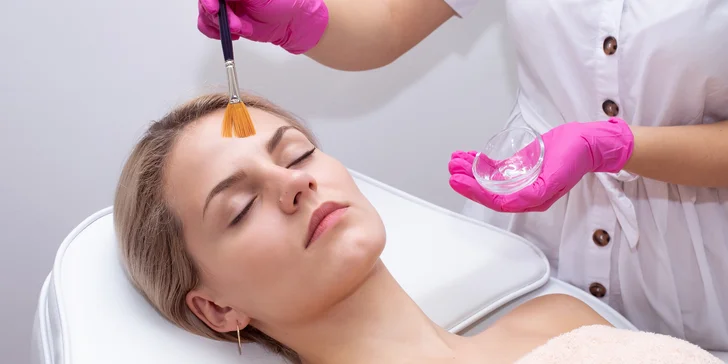Odstranění pigmentových skvrn: chemický a enzymatický peeling, IPL i mikrojehličkování