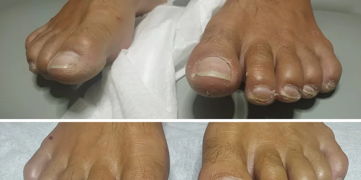 Dokonalé nožky: úprava nehtů, gel lak, kombinovaná i spa pedikúra