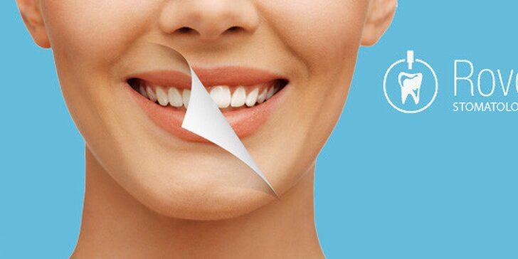 Dentální hygiena nebo ordinační bělení zubů 3v1