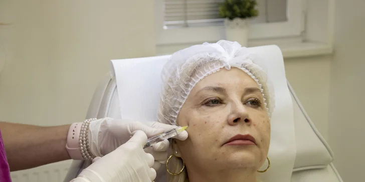 Kvalitní omlazující metoda: Skinbooster therapy vlastní krevní plazmou