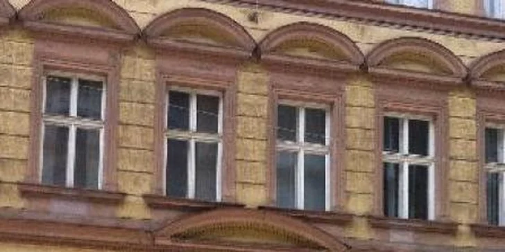 5× trvalá laserová epilace podpaží, lýtek, třísel a intimních partií