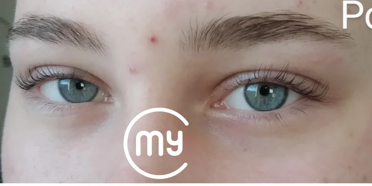 Lash Lifting: natočení, zvýraznění a vyživení řas na Vinohradech