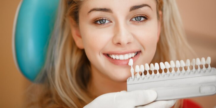 I vy můžete mít zářivý úsměv: Ordinační bělení zubů