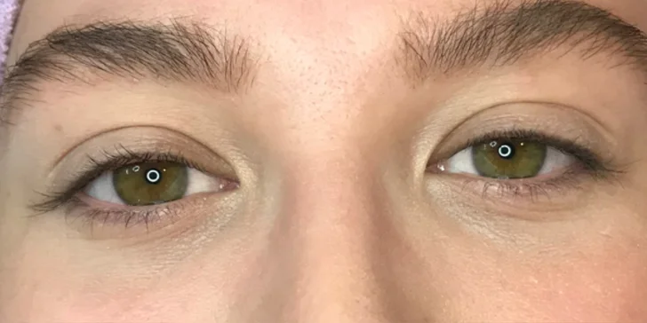 Zdravá a zářivá pleť: klasická kosmetika, ošetření problematické pleti i Lash Lifting