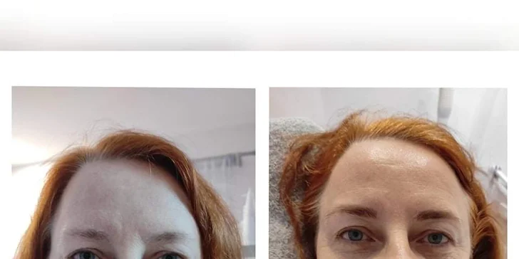 Kosmetické balíčky: základní, omlazující i liftingové ošetření nebo peeling