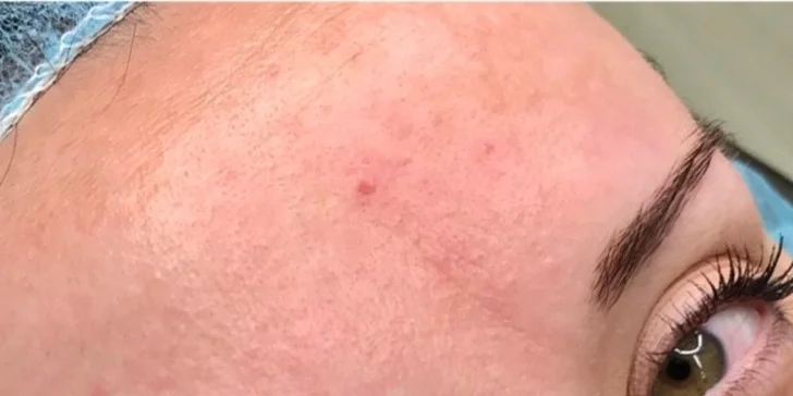 Permanentní make-up obočí: pudrová metoda či microblading a stínování