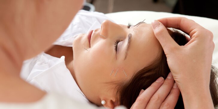 Přirozené omlazení pleti pomocí kosmetické akupunktury 1–10 ošetření
