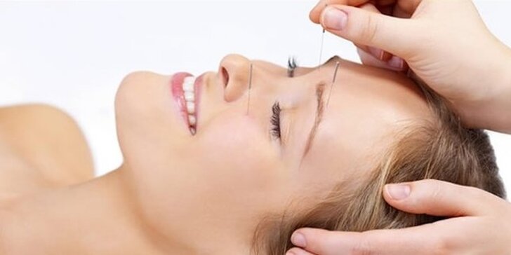 Přirozené omlazení pleti pomocí kosmetické akupunktury 1–5 ošetření
