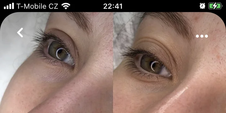 Kompletní péče o pleť: Kosmetické ošetření pleti, peeling i maska