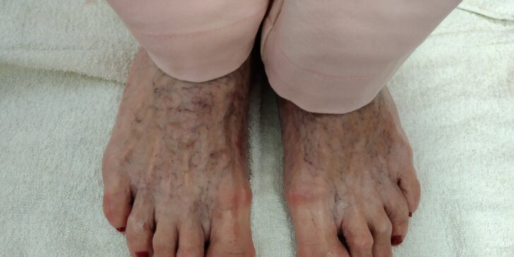 Péče o vaše nohy: mokrá pedikúra s možností laku, gel laku, P–shine nebo i masáže
