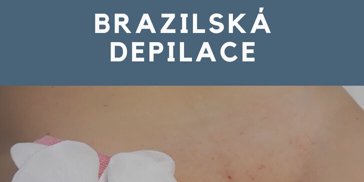 Depilace cukrovou pastou: brazilská nebo nohou, rukou a podpaží