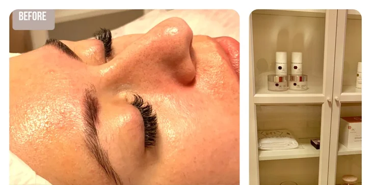 Ultrazvukové čištění pleti, anti-age peeling nebo omlazující kúra dle výběru