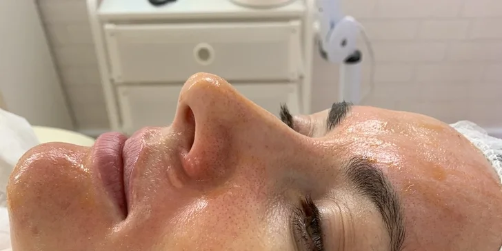Ultrazvukové čištění pleti, anti-age peeling nebo omlazující kúra dle výběru