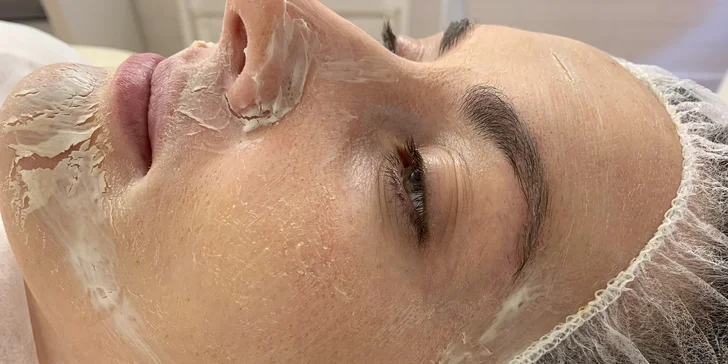 Ultrazvukové čištění pleti, anti-age peeling nebo omlazující kúra dle výběru