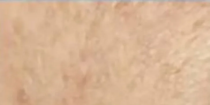 Ultrazvukové čištění pleti, anti-age peeling nebo omlazující kúra dle výběru